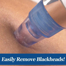 Load image into Gallery viewer, 4-In-1 Blackhead Whitehead Remover